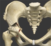 Periacetabular Osteotomy